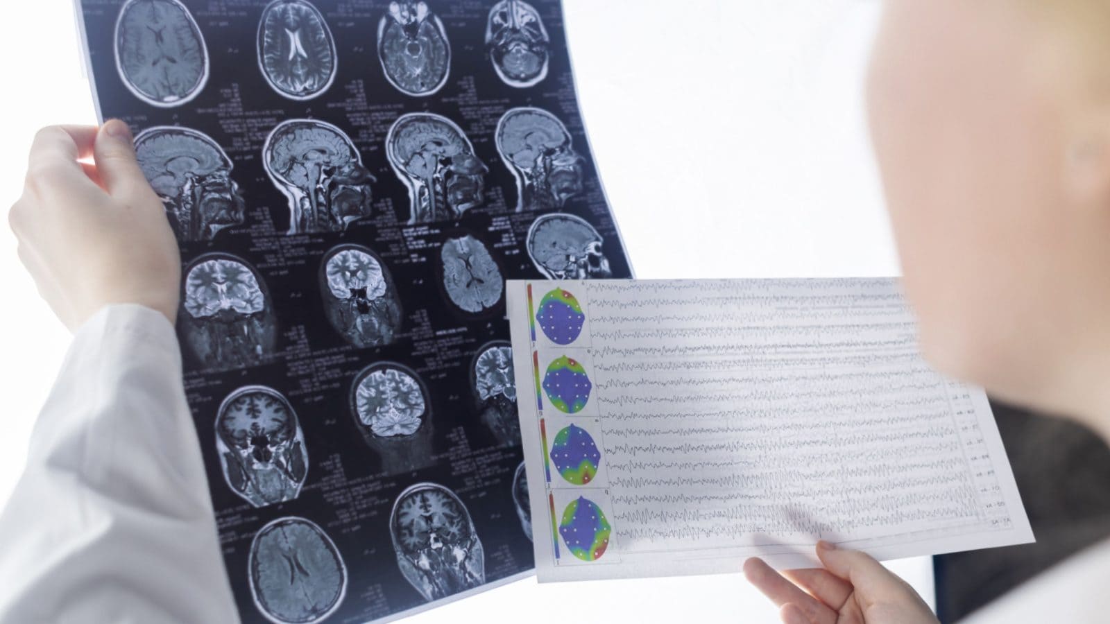 Doctor examining MRI results of a patient