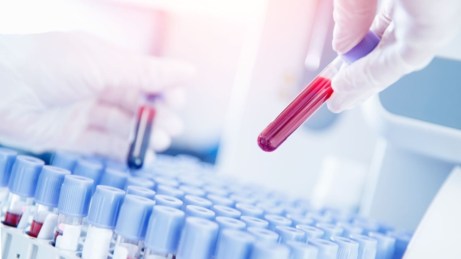 Lab worker with white gloves preparing for blood test